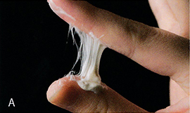 酸性ケラチントリートメント